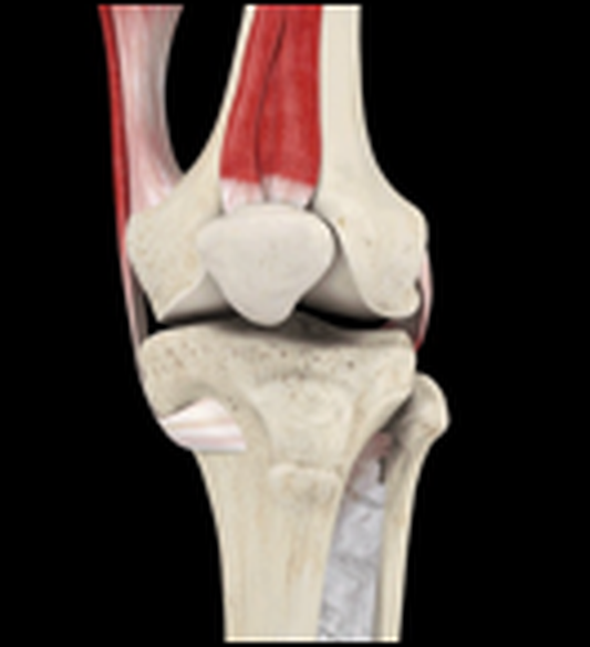 Anterior Cruciate Ligament (ACL) Injury | Roland Jeffery Physiotherapy